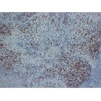 Myogenin Mouse Monoclonal AntibodyPT0193