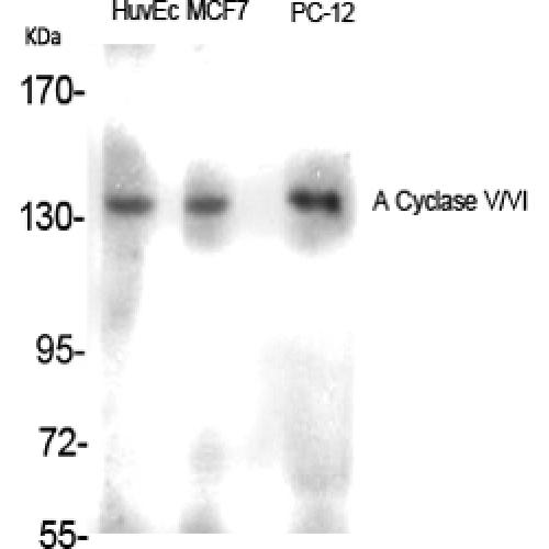 A Cyclase V/VI Rabbit pAb