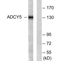 A Cyclase V/VI Rabbit pAb