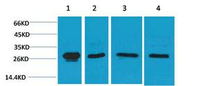 HSP27 Polyclonal Antibody