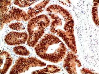 HSP40 Rabbit Polyclonal Antibody