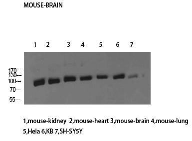 HSP70 Polyclonal Antibody