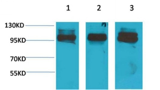 STAT2 Polyclonal Antibody