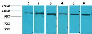 Stat2 Polyclonal Antibody