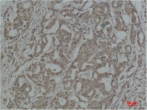 Stat3 Polyclonal Antibody