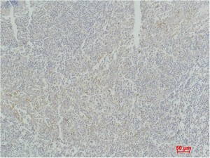 Stat4 Polyclonal Antibody