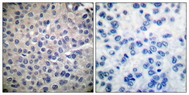 Stat4 Polyclonal Antibody