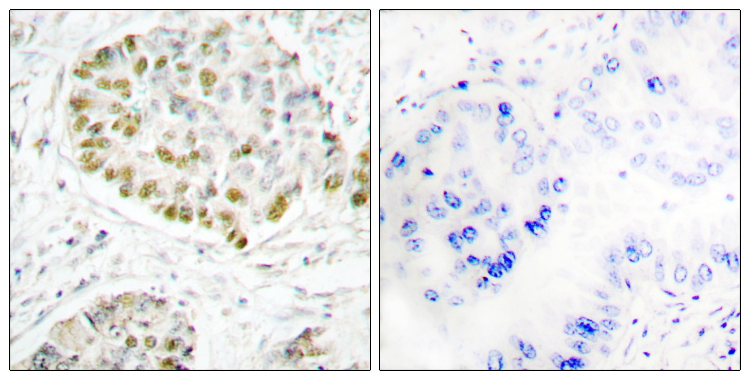 Stat5 Polyclonal Antibody