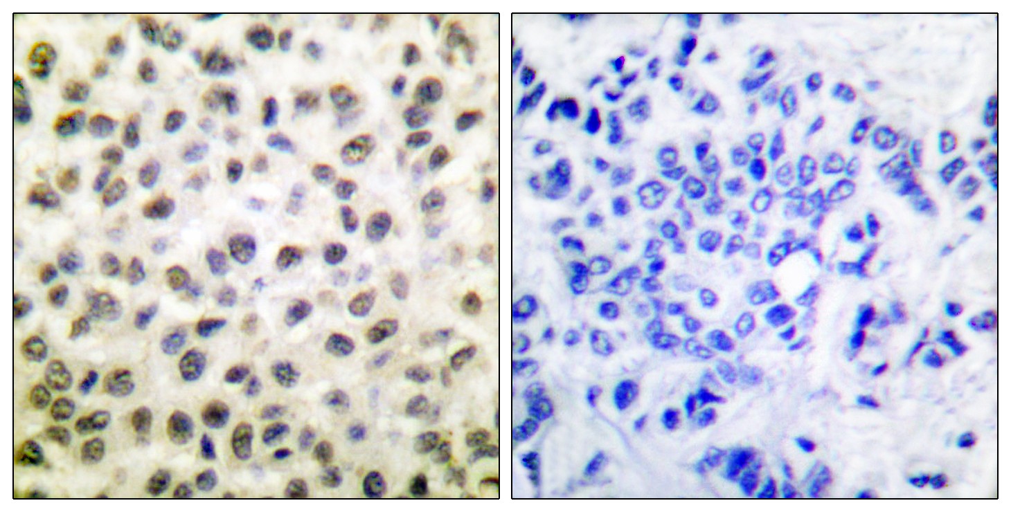 Stat5 Polyclonal Antibody