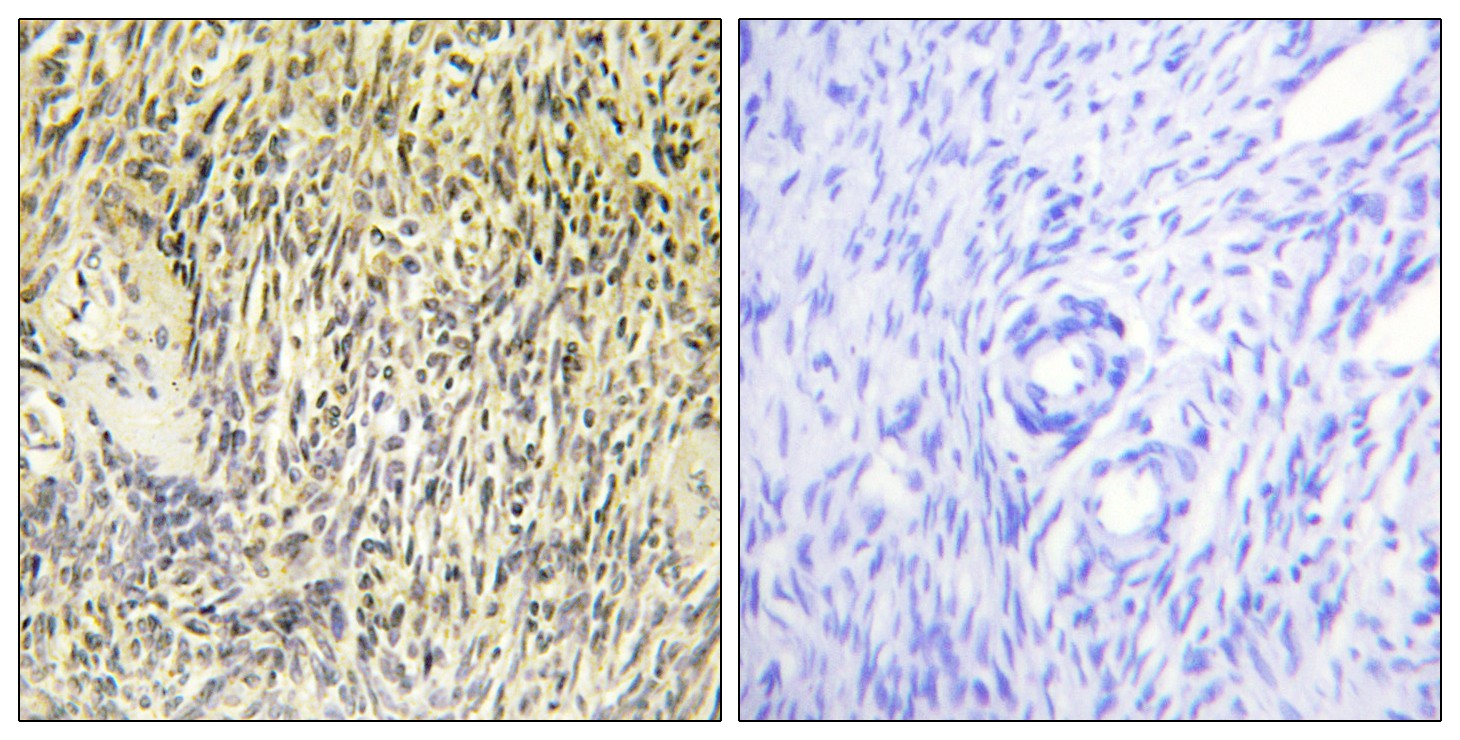 Syk Polyclonal Antibody