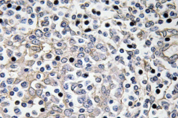 IL-16 Polyclonal Antibody