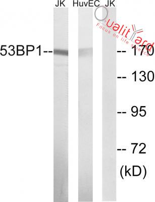 53BP1 Polyclonal Antibody