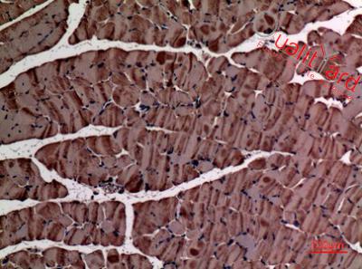 α-SMA Polyclonal Antibody