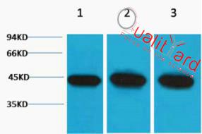 α-Smooth Muscle Actin Polyclonal Antibody