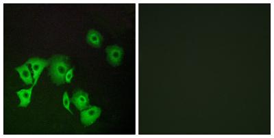 FoxE1 Polyclonal Antibody