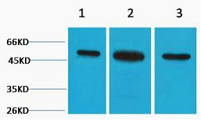 β II Tubulin Polyclonal Antibody