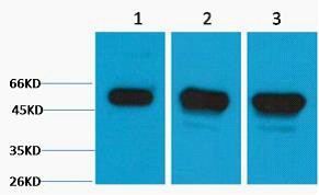 β III Tubulin Polyclonal Antibody