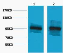 β-Catenin Polyclonal Antibody