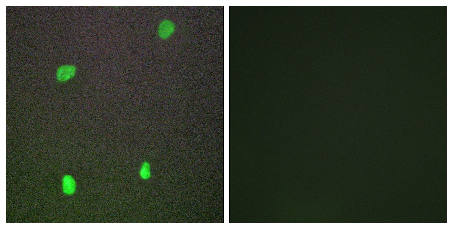 XRCC3 Polyclonal Antibody