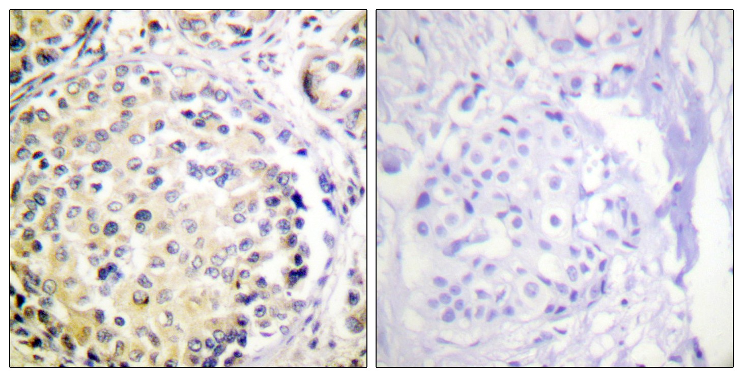 Vimentin Polyclonal Antibody