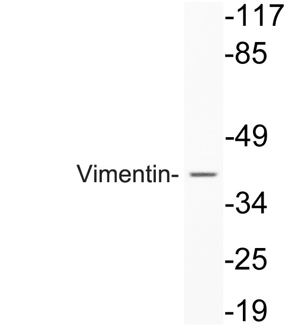 Vimentin Polyclonal Antibody