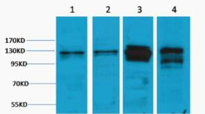 Vinculin Polyclonal Antibody