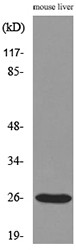 TNF-α Polyclonal Antibody