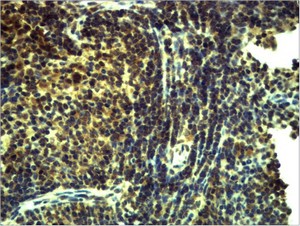 TLR8 Polyclonal Antibody