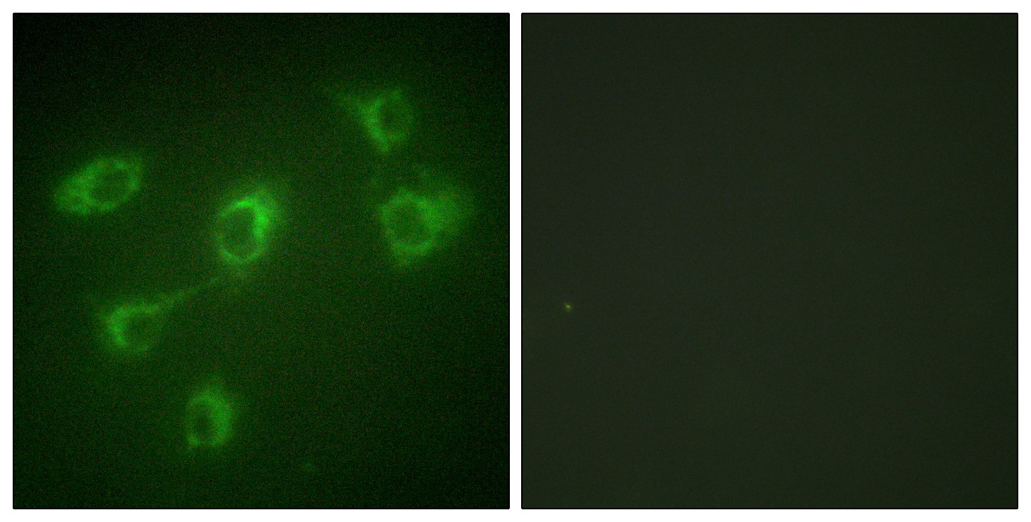 TGFβ RIII Polyclonal Antibody