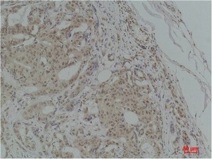 TGFβ1 Polyclonal Antibody