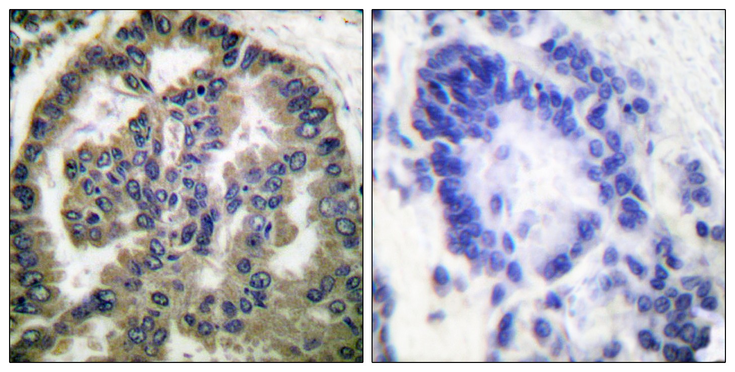 TGFβ2 Polyclonal Antibody