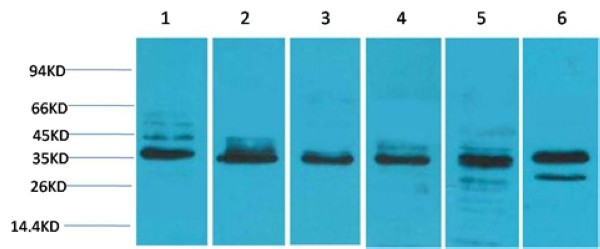 TBP Polyclonal Antibody