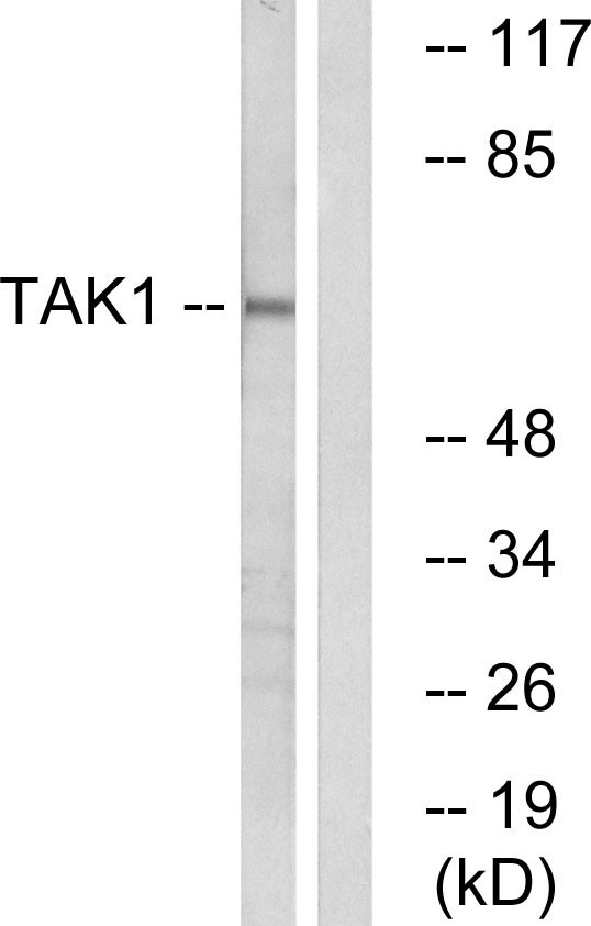 Tak1 Polyclonal Antibody