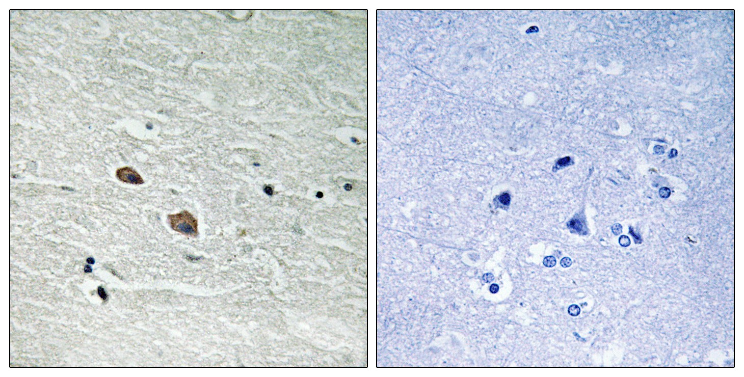 Tak1 Polyclonal Antibody