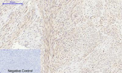 Tau Polyclonal Antibody