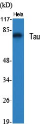 Tau Polyclonal Antibody