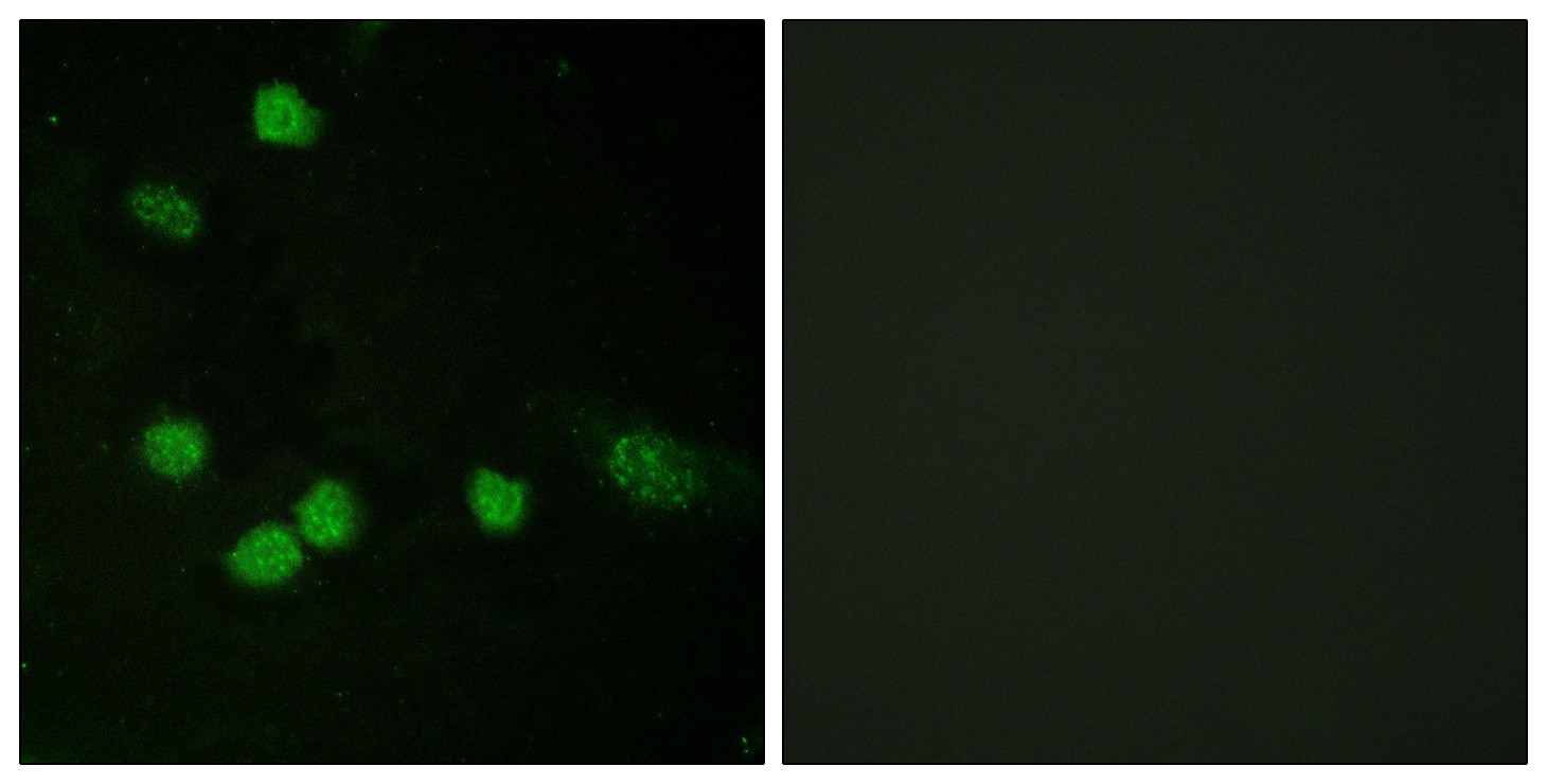 Raf-1 Polyclonal Antibody