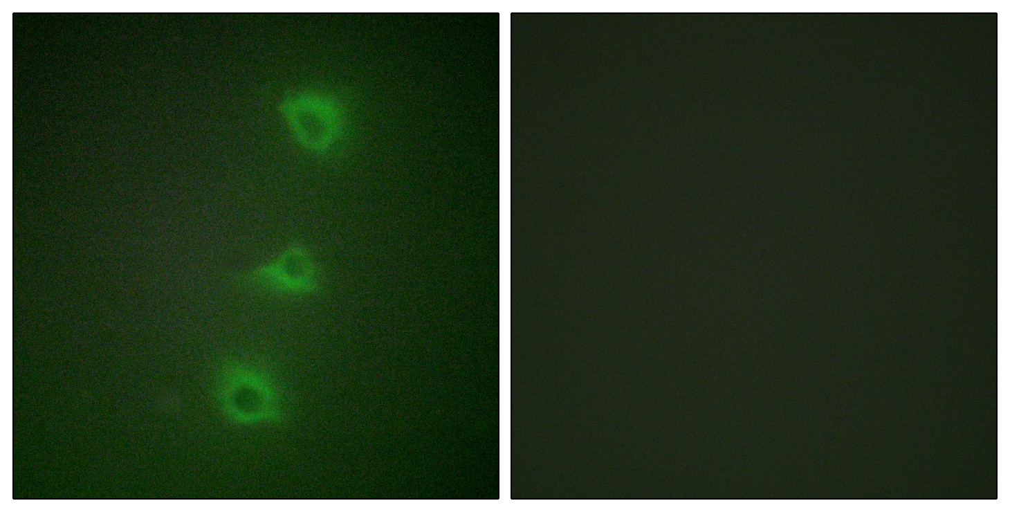 Raf-B Polyclonal Antibody