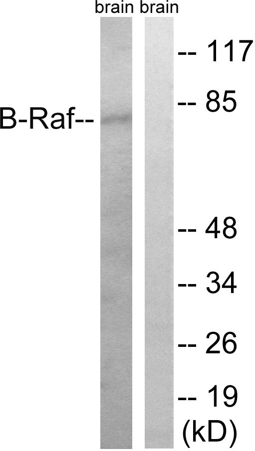 Raf-B Polyclonal Antibody