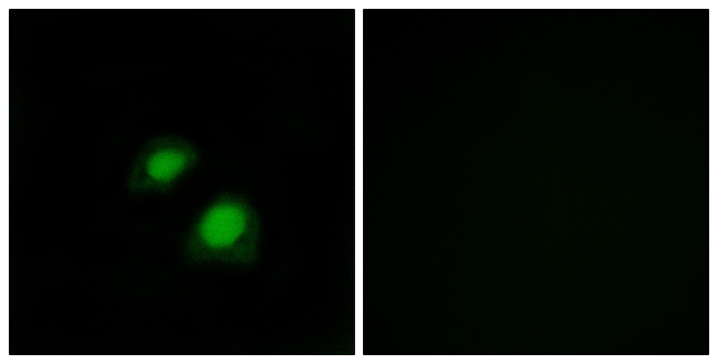 Rac GAP1 Polyclonal Antibody