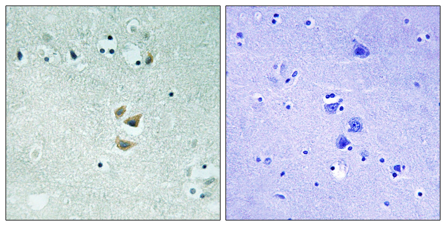 PKC α Polyclonal Antibody