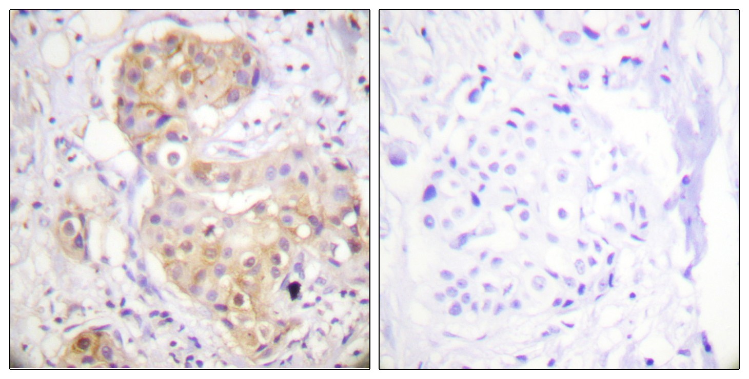 PKC δ Polyclonal Antibody