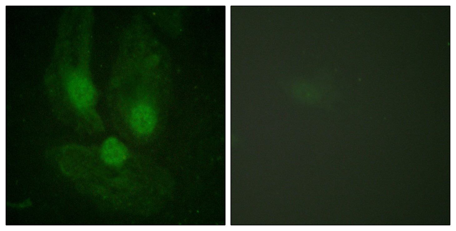 PKC ζ Polyclonal Antibody