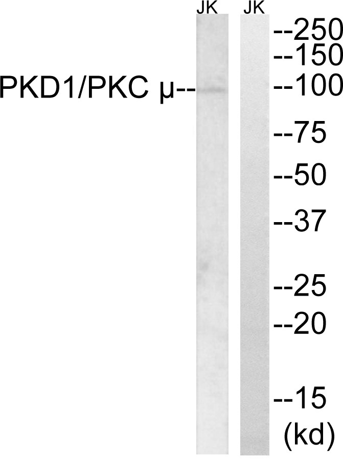 PKD1 Polyclonal Antibody