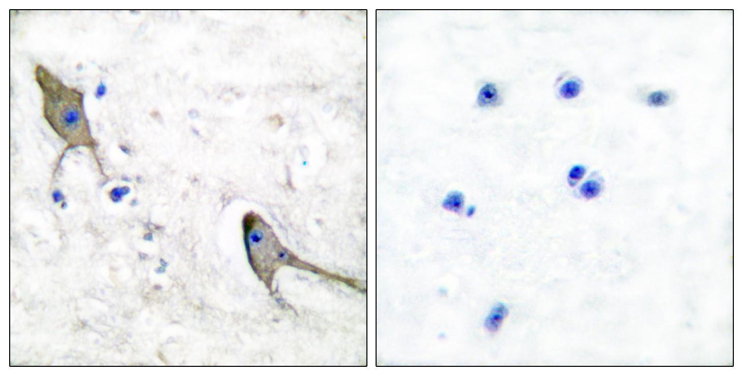 PYK2 Polyclonal Antibody