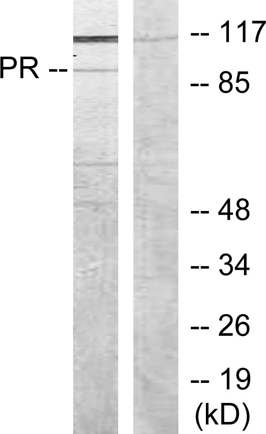 PR Polyclonal Antibody