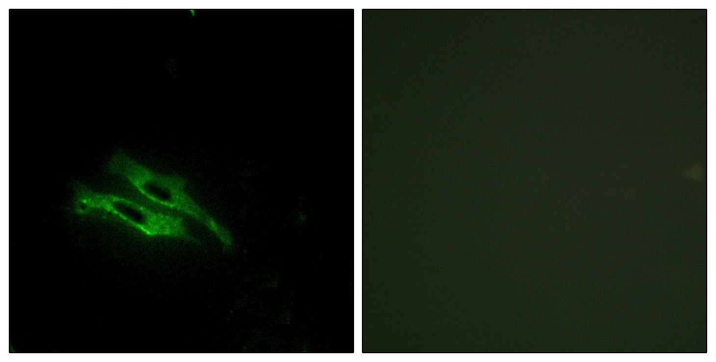 Prothrombin Polyclonal Antibody