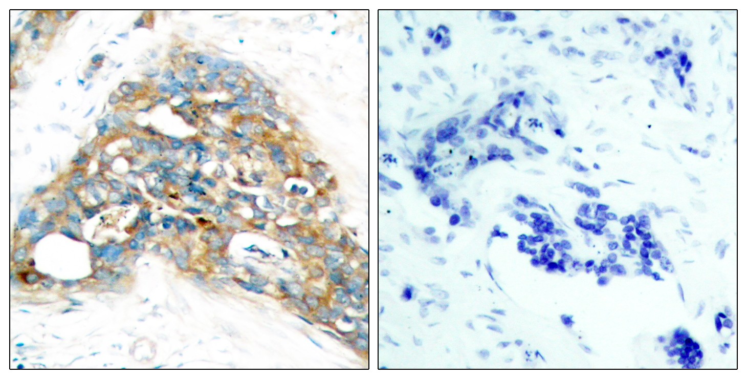 PTEN Polyclonal Antibody