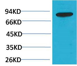 PI3 Kinase p85β Polyclonal Antibody