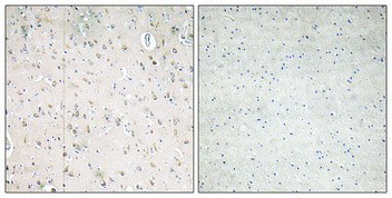 PI3 Kinase p85β Polyclonal Antibody